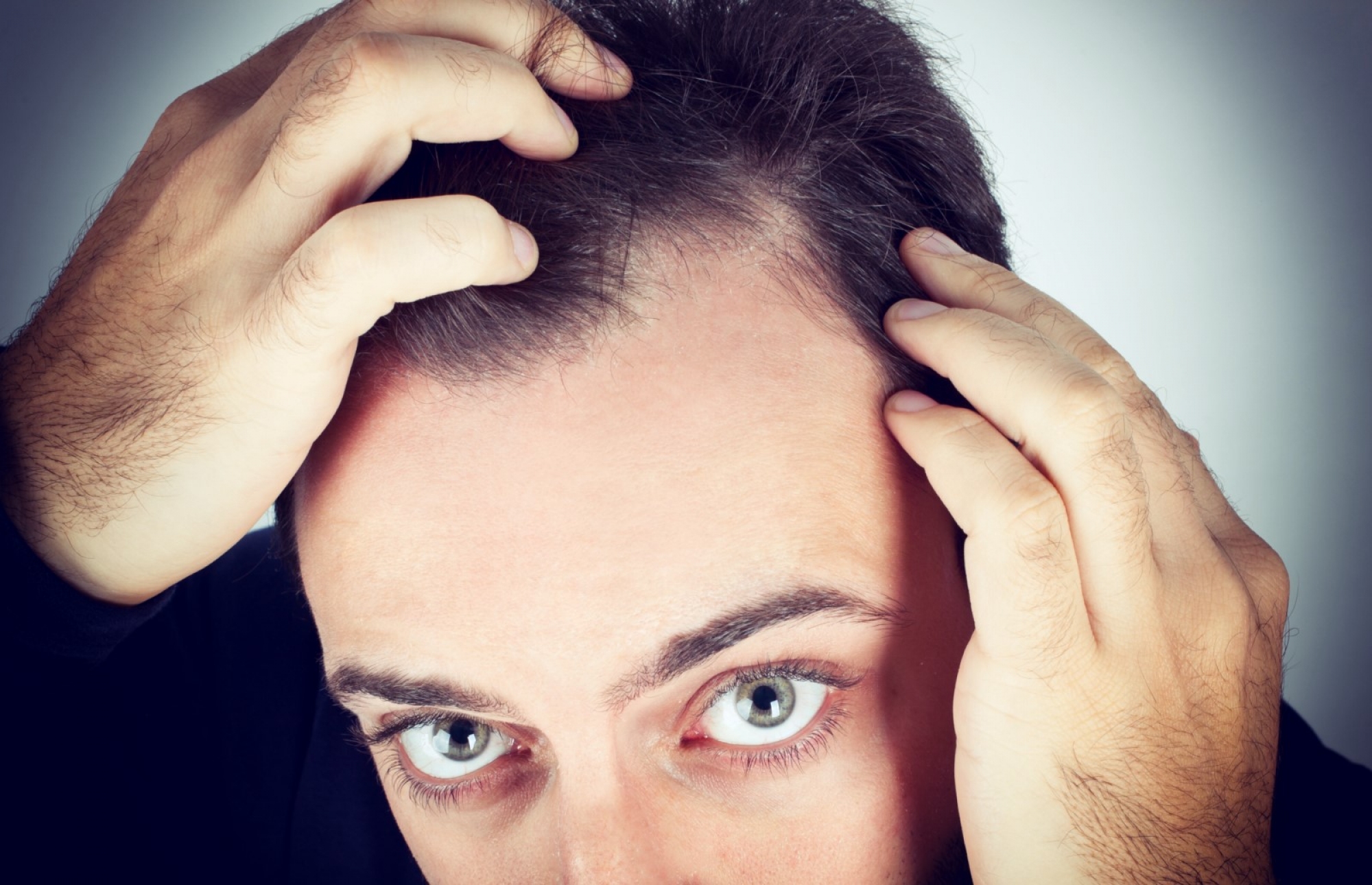 Implants capillaires moins chers à la Clinique Lisboa Hair Restoration